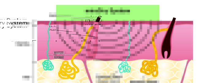 miraDry System