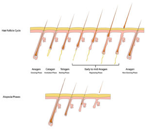 Hair follicle cycle and alopecia phases Boston & Wellesley